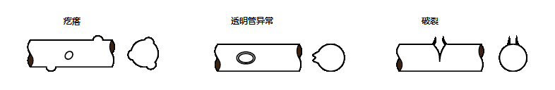 外徑凹凸檢測儀在線纜行業(yè)的應用案例